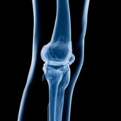 Артроскопия коленного сустава в Турции