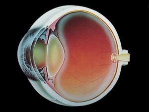 Лечение катаракты в Индии
