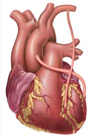 Аортокоронарное шунтирование